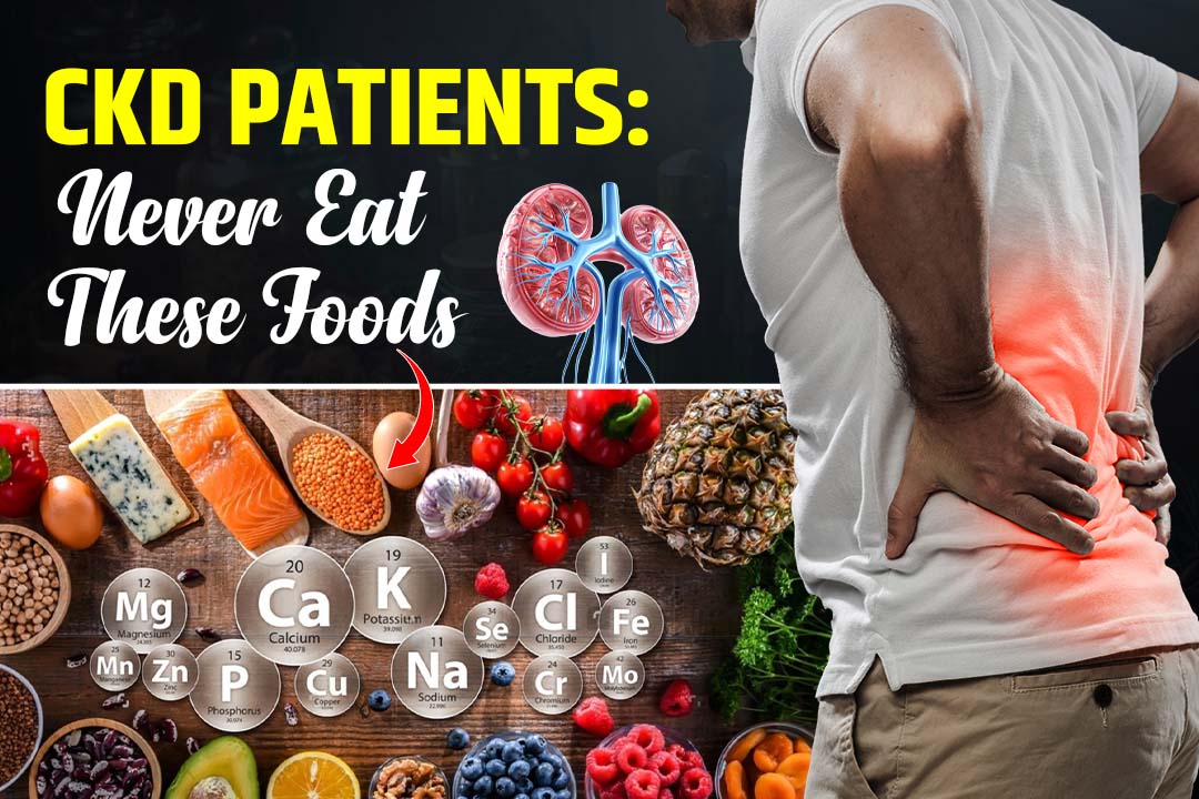 CKD Patients: Never Eat These Foods Doctors Warn!